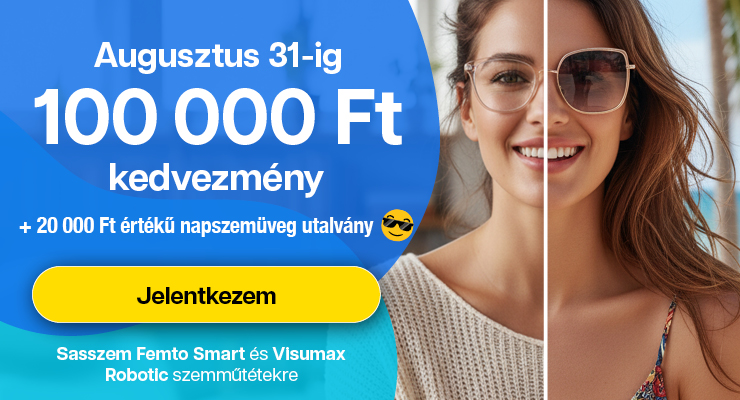 Sasszem FEMTO Smart 200.000 Ft kedvezmény