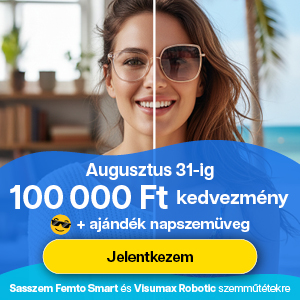 Sasszem FEMTO Smart 200.000 Ft kedvezmény