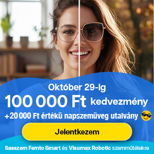 Sasszem FEMTO Smart 200.000 Ft kedvezmény