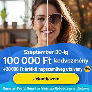 Sasszem FEMTO Smart 200.000 Ft kedvezmény