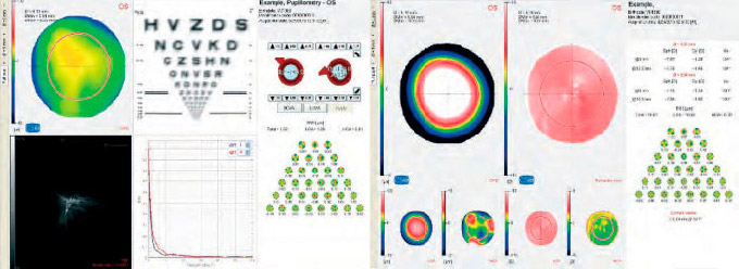 Schwind Peramis mérőezköz